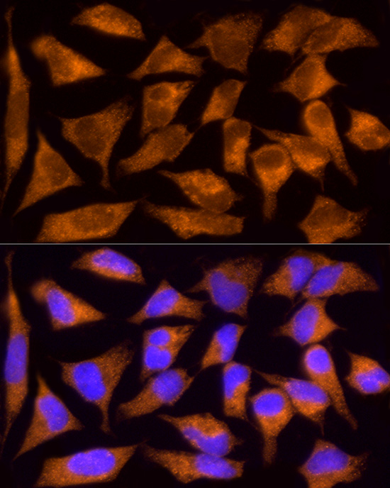 COL4A3 Rabbit polyclonal antibody