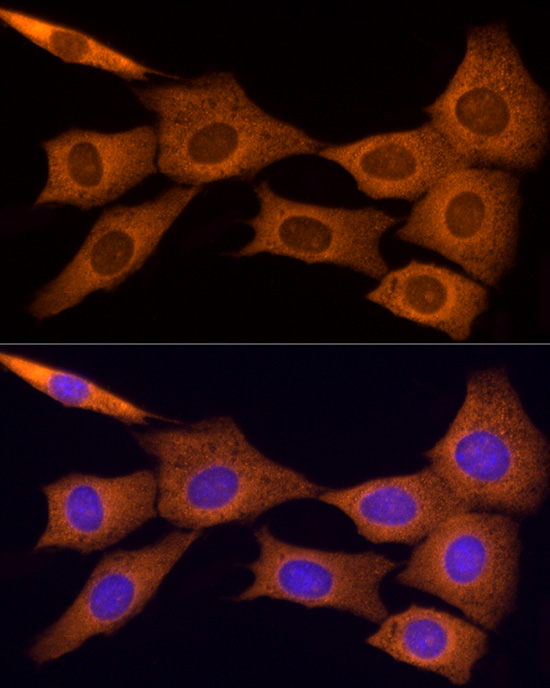 COL4A3 Rabbit polyclonal antibody