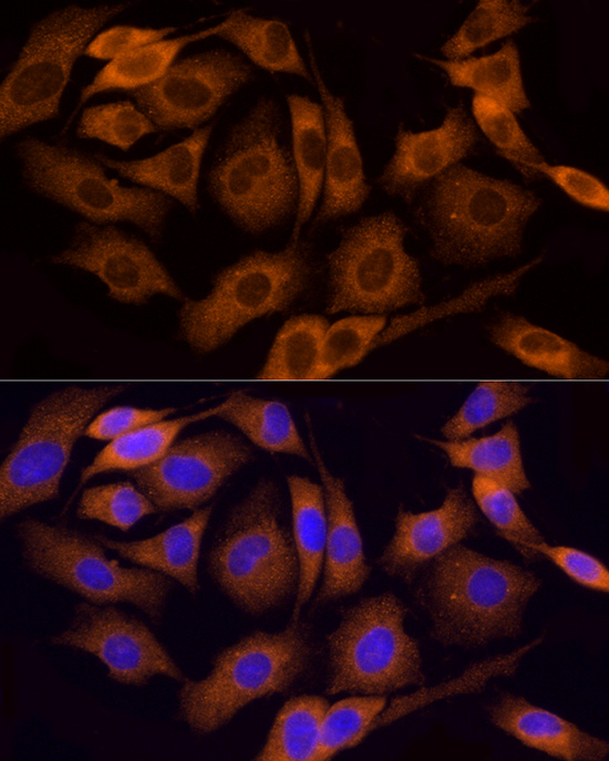 COL4A3 Rabbit polyclonal antibody
