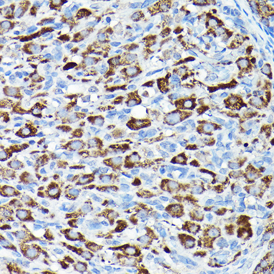 CYP11A1 Rabbit polyclonal antibody