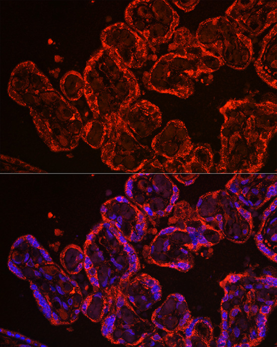 CYP11A1 Rabbit polyclonal antibody