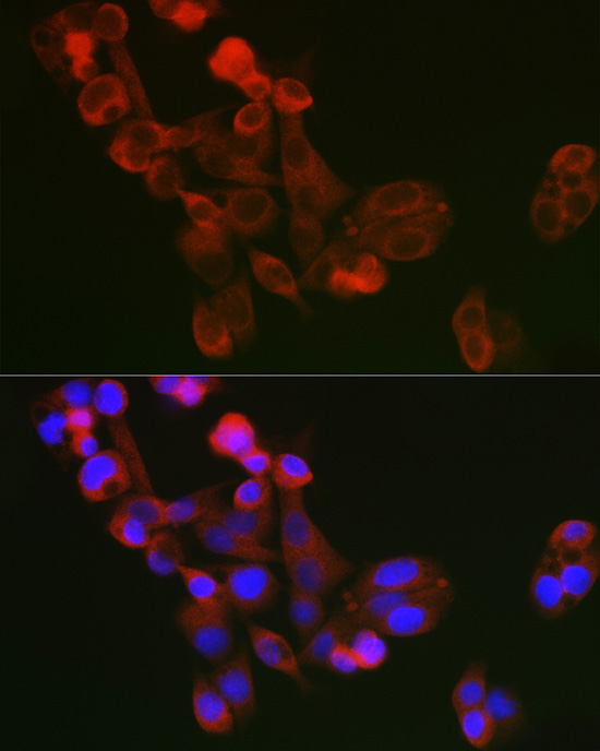 ECM1 Rabbit polyclonal antibody