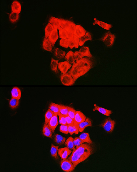 ECM1 Rabbit polyclonal antibody