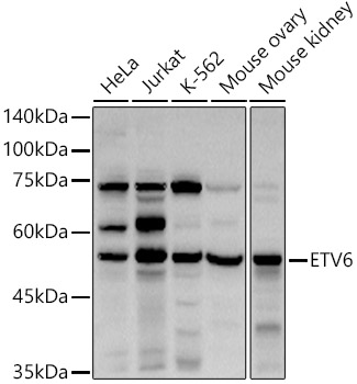 ETV6 Rabbit polyclonal antibody