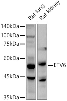 ETV6 Rabbit polyclonal antibody