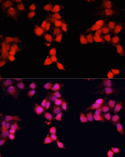 ENO3 Rabbit polyclonal antibody