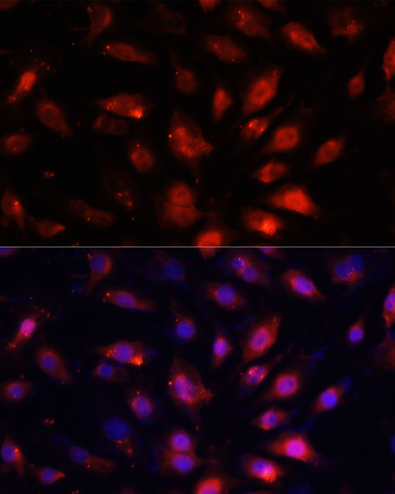 ENO3 Rabbit polyclonal antibody