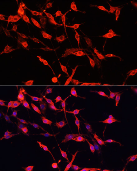ENO3 Rabbit polyclonal antibody