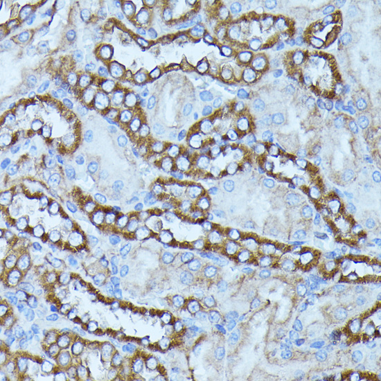 FGD1 Rabbit polyclonal antibody