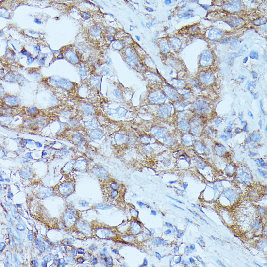 FGD1 Rabbit polyclonal antibody