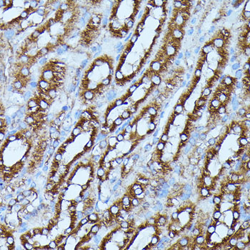 FGD1 Rabbit polyclonal antibody