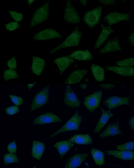 FGD1 Rabbit polyclonal antibody