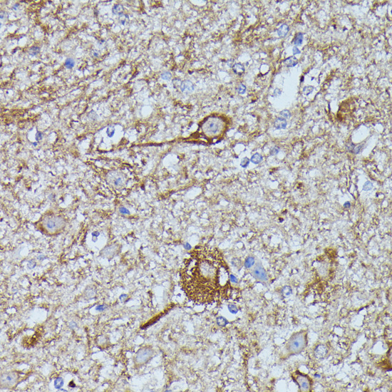 FKBP1B Rabbit polyclonal antibody