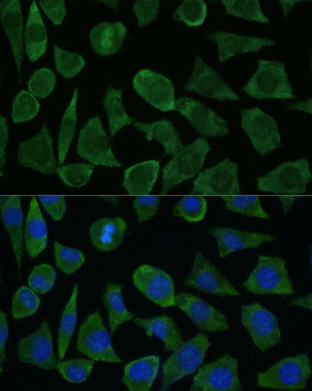FKBP1B Rabbit polyclonal antibody