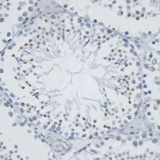 MSH6 Rabbit polyclonal antibody
