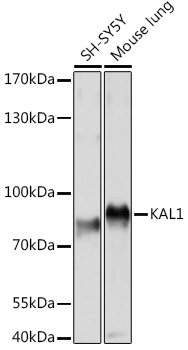 KAL1 Rabbit polyclonal antibody