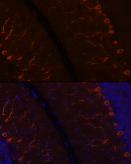 KAL1 Rabbit polyclonal antibody