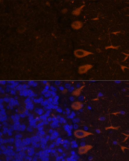 KAL1 Rabbit polyclonal antibody