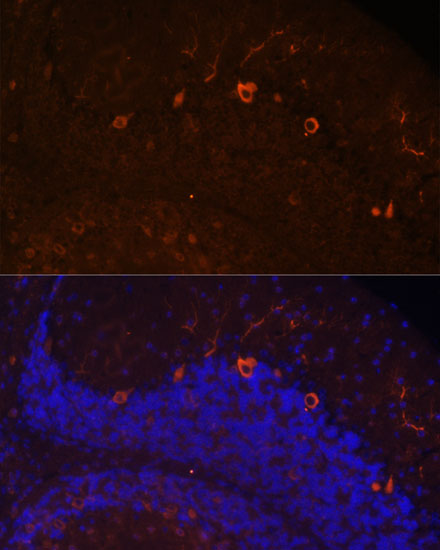 KAL1 Rabbit polyclonal antibody