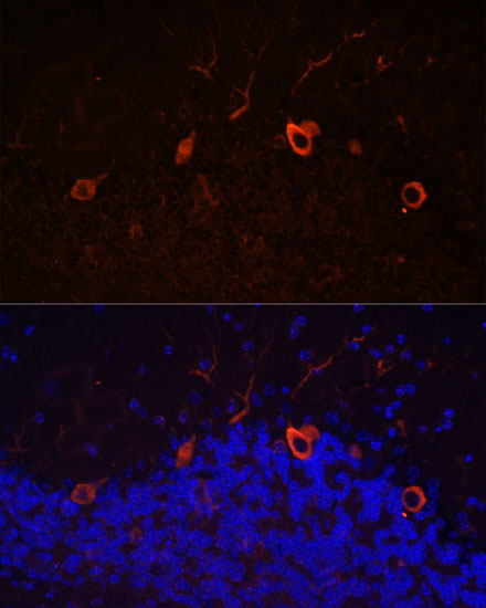 KAL1 Rabbit polyclonal antibody