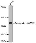 Western blot - Cytokeratin 13 (KRT13) Rabbit pAb (A16393)