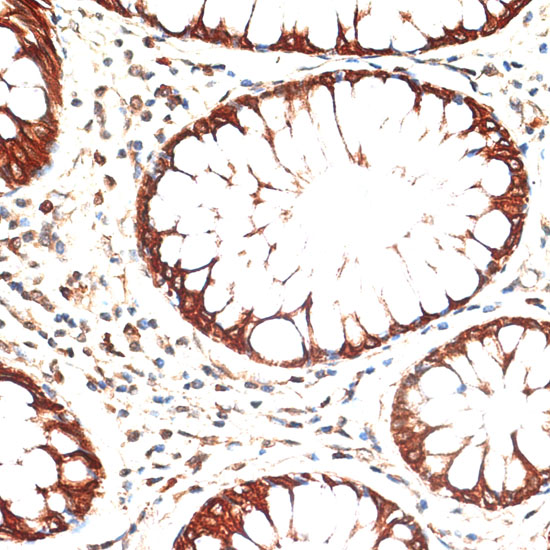 Cytokeratin 13 (KRT13) Rabbit polyclonal antibody