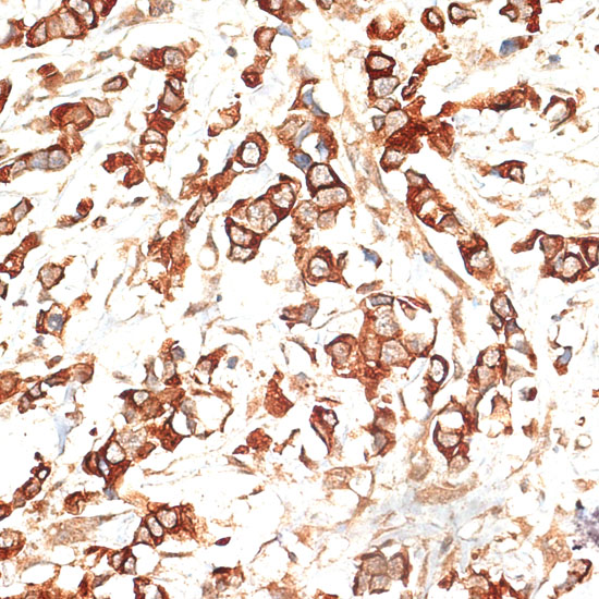 Cytokeratin 13 (KRT13) Rabbit polyclonal antibody
