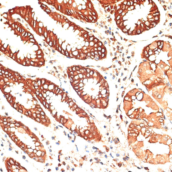 Cytokeratin 13 (KRT13) Rabbit polyclonal antibody
