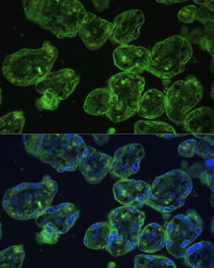 Cytokeratin 13 (KRT13) Rabbit polyclonal antibody