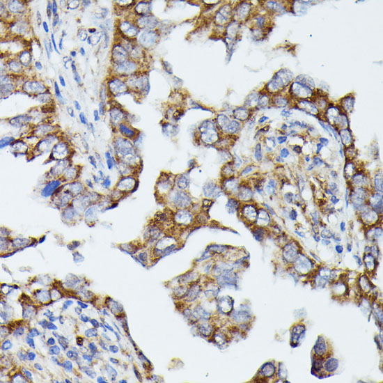 MTIF2 Rabbit polyclonal antibody