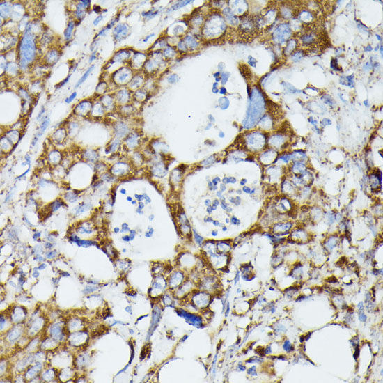 MTIF2 Rabbit polyclonal antibody