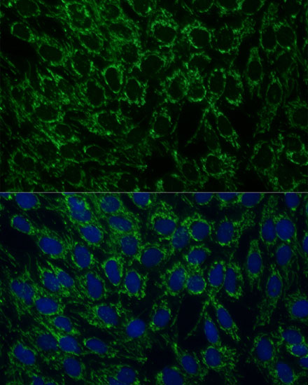 MTIF2 Rabbit polyclonal antibody