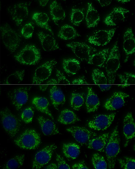 MTIF2 Rabbit polyclonal antibody