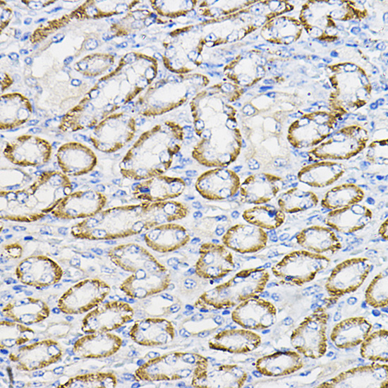 NUBP1 Rabbit polyclonal antibody