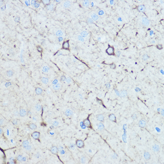 Neurofilament M Rabbit polyclonal antibody