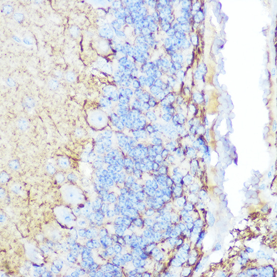 Neurofilament M Rabbit polyclonal antibody