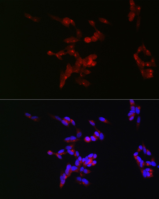 Neurofilament M Rabbit polyclonal antibody