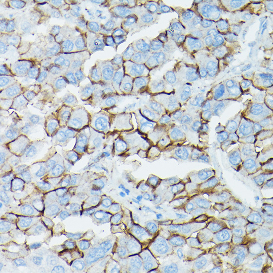 D Delta-Catenin/p120 Catenin Rabbit polyclonal antibody