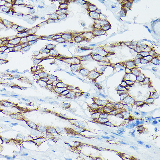D Delta-Catenin/p120 Catenin Rabbit polyclonal antibody