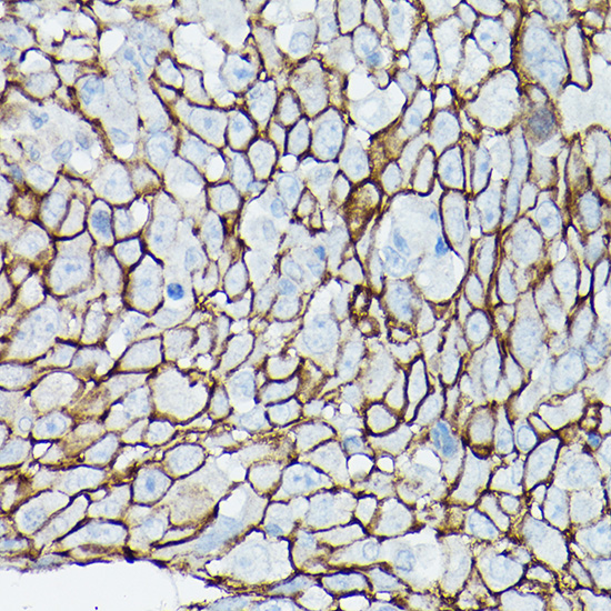 D Delta-Catenin/p120 Catenin Rabbit polyclonal antibody