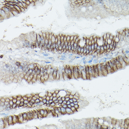 D Delta-Catenin/p120 Catenin Rabbit polyclonal antibody