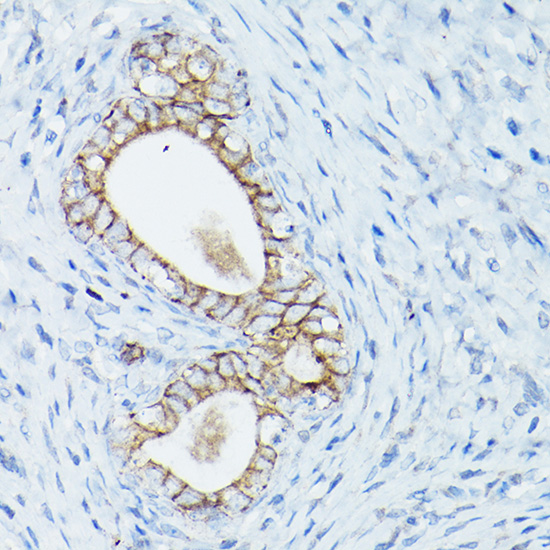 D Delta-Catenin/p120 Catenin Rabbit polyclonal antibody