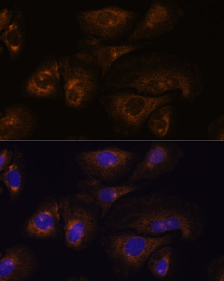 PRSS8 Rabbit polyclonal antibody