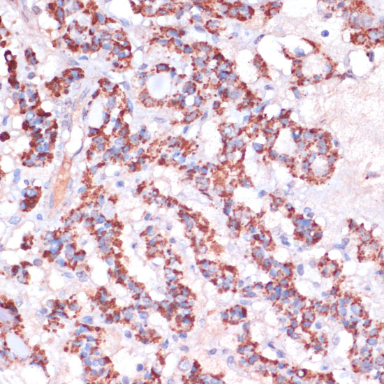MRPL23 Rabbit polyclonal antibody