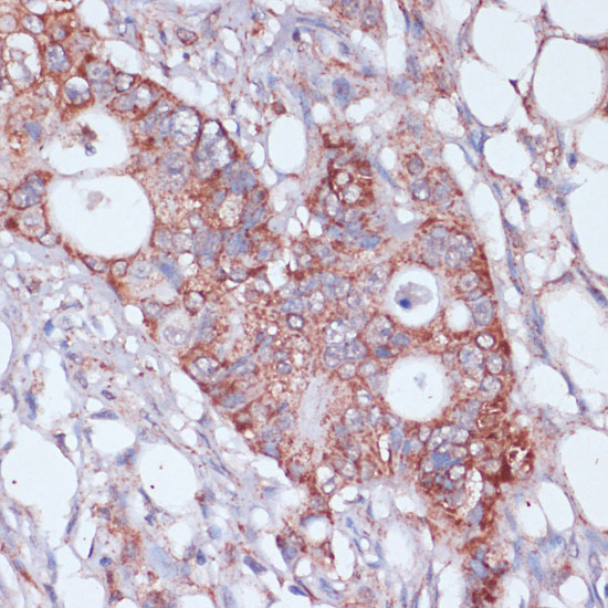 MRPL23 Rabbit polyclonal antibody