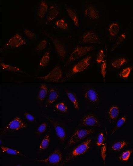 MRPL23 Rabbit polyclonal antibody