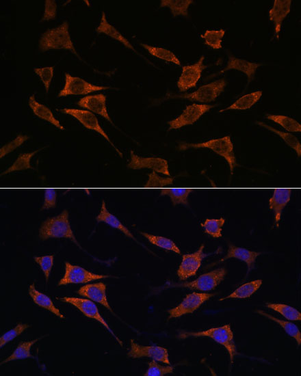 RPS17 Rabbit polyclonal antibody