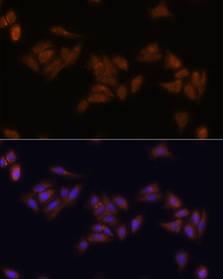 RPS17 Rabbit polyclonal antibody