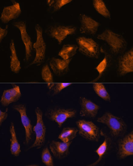 RPS17 Rabbit polyclonal antibody