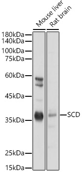 SCD1 Rabbit polyclonal antibody